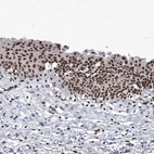 Immunohistochemical staining of human urinary bladder shows strong nuclear positivity in urothelial cells.