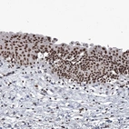 Immunohistochemical staining of human urinary bladder shows strong nuclear positivity in urothelial cells.