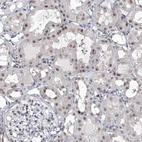 Immunohistochemical staining of human kidney shows moderate nuclear positivity in cells in tubules.