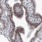 Immunohistochemical staining of human fallopian tube shows strong nuclear positivity in glandular cells.