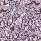 Immunohistochemical staining of human duodenum shows strong nuclear positivity in glandular cells.
