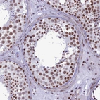 Immunohistochemical staining of human testis shows strong nuclear positivity in cells in seminiferous ducts.