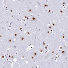 Immunohistochemical staining of human cerebral cortex shows strong nuclear positivity in neurons.