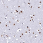 Immunohistochemical staining of human cerebral cortex shows strong nuclear positivity in neurons.