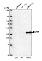Western blot analysis in U2OS cells transfected with control siRNA, target specific siRNA probe #1 and #2, using Anti-U2AF1 antibody. Remaining relative intensity is presented.