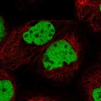Immunofluorescent staining of human cell line A-431 shows localization to nucleoplasm.