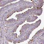 Anti-GNG12 Antibody