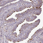 Immunohistochemical staining of human fallopian tube shows strong positivity in cilia in glandular cells.