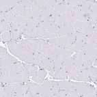 Immunohistochemical staining of human skeletal muscle shows no positivity in myocytes as expected.