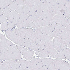 Anti-GNG12 Antibody