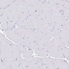 Immunohistochemical staining of human skeletal muscle shows no positivity in myocytes as expected.