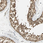 Immunohistochemical staining of human testis shows strong cytoplasmic positivity in cells in seminiferous ducts.