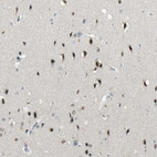Immunohistochemical staining of human cerebral cortex shows strong nuclear positivity in neurons.