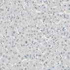 Immunohistochemical staining of human liver shows no positivity in hepatocytes as expected.