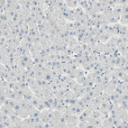 Anti-PRMT5 Antibody