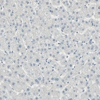 Immunohistochemical staining of human liver shows no positivity in hepatocytes as expected.