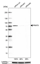 Western blot analysis in Hep-G2 cells transfected with control siRNA, target specific siRNA probe #1 and #2, using Anti-PRMT5 antibody. Remaining relative intensity is presented. Loading control: Anti-GAPDH.