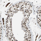 Immunohistochemical staining of human testis shows strong nuclear positivity in cells in seminiferous ducts.
