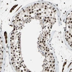 Immunohistochemical staining of human testis shows strong nuclear positivity in cells in seminiferous ducts.
