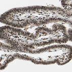 Immunohistochemical staining of human fallopian tube shows strong nuclear positivity in glandular cells.