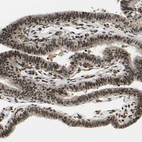 Immunohistochemical staining of human fallopian tube shows strong nuclear positivity in glandular cells.
