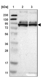 Lane 1: Marker [kDa] 230, 130, 95, 72, 56, 36, 28, 17, 11_br/_Lane 2: Human cell line RT-4_br/_Lane 3: Human cell line U-251MG sp