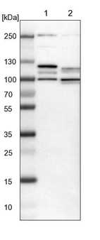 Lane 1: NIH-3T3 cell lysate (Mouse embryonic fibroblast cells)_br/_Lane 2: NBT-II cell lysate (Rat Wistar bladder tumour cells)