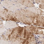 Immunohistochemical staining of human skeletal muscle shows strong cytoplasmic positivity in myocytes.