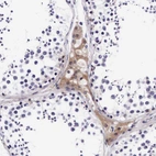Immunohistochemical staining of human testis shows strong cytoplasmic positivity in Leydig cells.