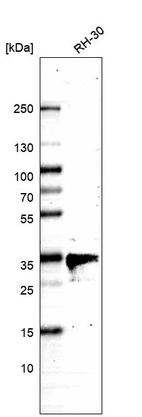 Western blot analysis in human cell line RH-30.