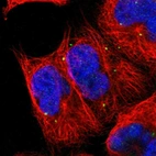 Immunofluorescent staining of human cell line A-431 shows localization to vesicles.