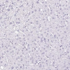 Immunohistochemical staining of human liver shows no positivity in hepatocytes as expected.