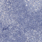 Immunohistochemical staining of human tonsil shows no positivity in non-germinal center cells as expected.