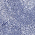 Immunohistochemical staining of human tonsil shows no positivity in non-germinal center cells as expected.