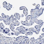Immunohistochemical staining of human placenta shows no positivity in trophoblastic cells as expected.
