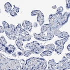 Immunohistochemical staining of human placenta shows no positivity in trophoblastic cells as expected.