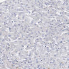 Immunohistochemical staining of human liver shows no positivity in hepatocytes as expected.