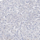 Immunohistochemical staining of human liver shows no positivity in hepatocytes as expected.