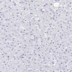 Immunohistochemical staining of human liver shows no positivity in hepatocytes as expected.