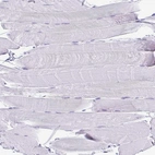 Immunohistochemical staining of human skeletal muscle shows no positivity in myocytes as expected.