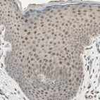 Immunohistochemical staining of human skin shows moderate cytoplasmic and nuclear positivity in squamous epithelial cells.