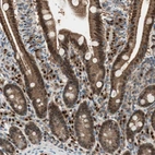 Immunohistochemical staining of human duodenum shows strong cytoplasmic and nuclear positivity in glandular cells.
