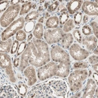Immunohistochemical staining of human kidney shows moderate cytoplasmic and nuclear positivity in cells in tubules.