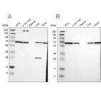 Western blot analysis using Anti-LTA4H antibody HPA008399 (A) shows similar pattern to independent antibody HPA017017 (B).