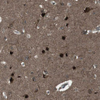 Immunohistochemical staining of human cerebral cortex shows strong nuclear and cytoplasmic positivity in neurons.