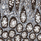 Immunohistochemical staining of human rectum shows strong nuclear and cytoplasmic positivity in glandular cells.