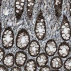 Immunohistochemical staining of human rectum shows strong nuclear and cytoplasmic positivity in glandular cells.