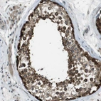 Immunohistochemical staining of human testis shows strong nuclear and cytoplasmic positivity in cells in seminiferous ducts.