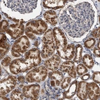 Immunohistochemical staining of human kidney shows strong cytoplasmic granular positivity in cells in tubules.
