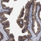 Immunohistochemical staining of human prostate shows strong cytoplasmic granular positivity in glandular cells.